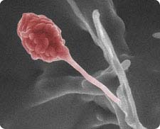 Colorized environmental scanning electron microscope photo of Gliocladium roseum, an endophytic fungus that produces myco-diesel hydrocarbons.